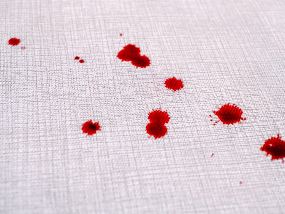 Drops of blood on the carpet
